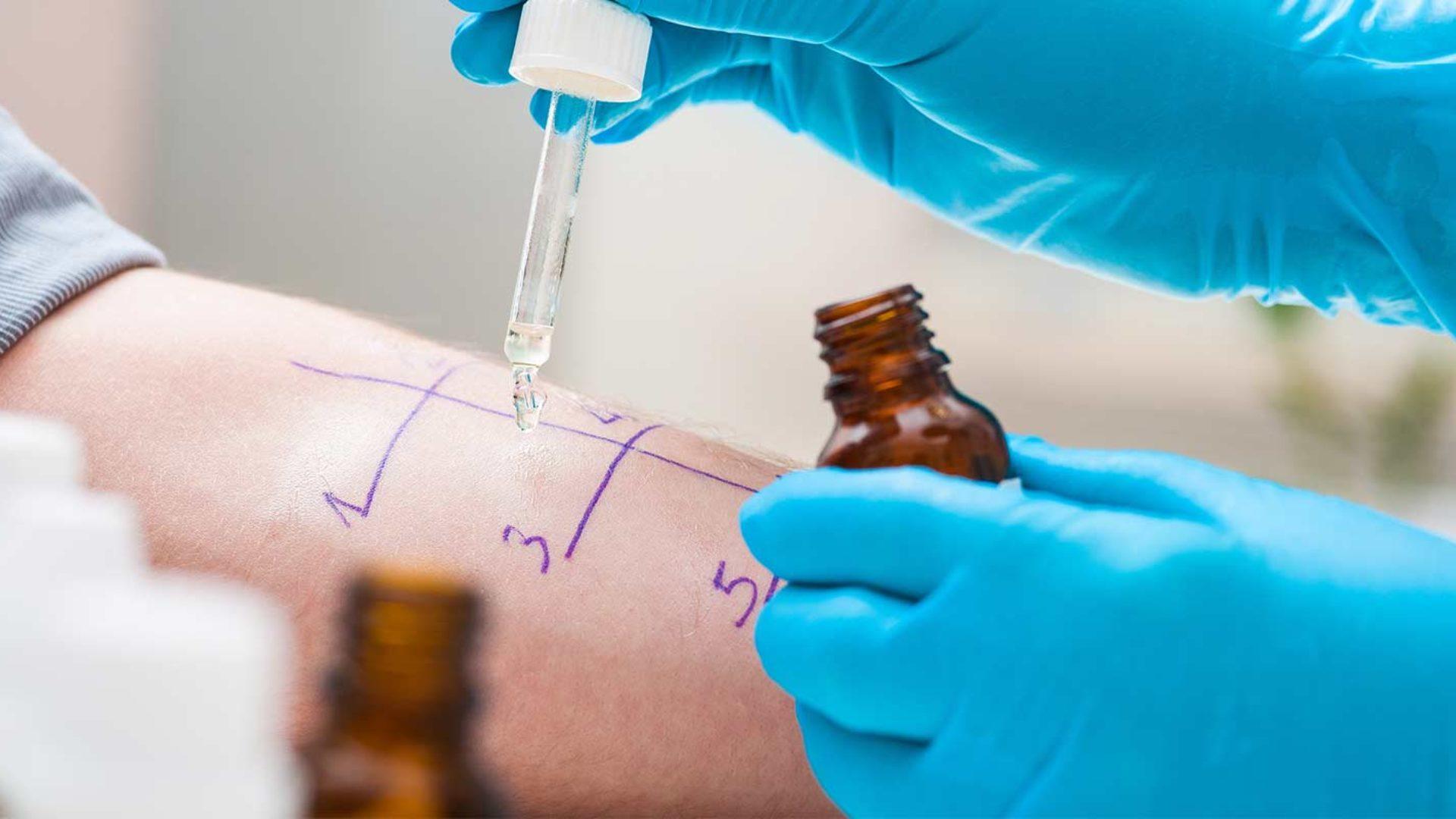 Im MVZ Hansaklinik in Dortmund führen wir umfassende Allergietests durch.