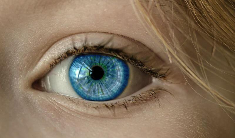 Blaues Auge nach der Schlupflider-Entfernung