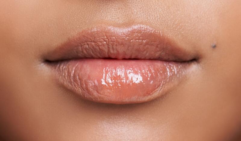 Lippen aufspritzen mit Hyaluron in Dortmund [ohne OP]